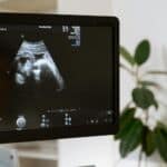 The Complex Truth of Health Tech: Why Greater Ultrasound Availability Doesn’t Always Benefit Patients